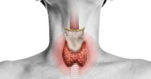 Understanding Thyroid Disorder