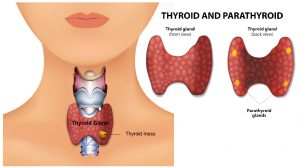 Thyroid Management 