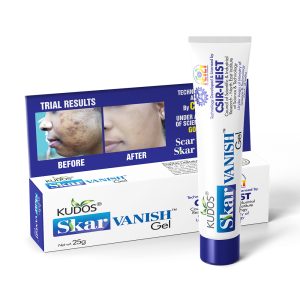 Skar Vanish Gel - Your Ultimate Solution for Scar Removal