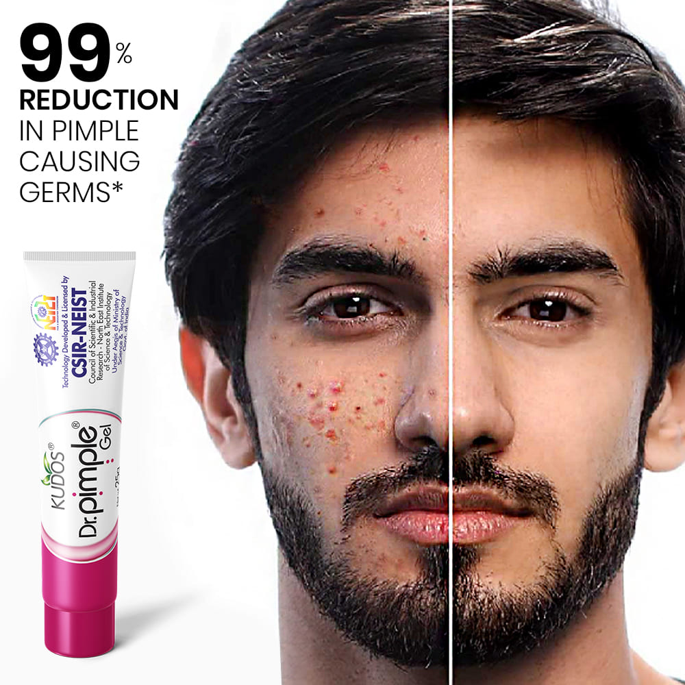 Dr. Pimple Kit ( Pack Of 4 ) - Image 7